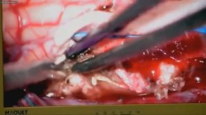 Дмитрий Кандыба (russian) ICENS 2022