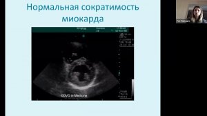 BLUE протокол Кринева Е Л