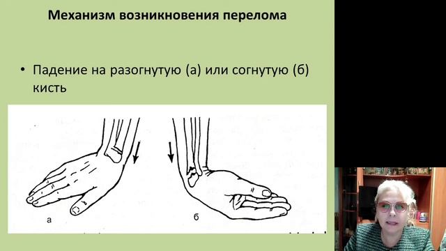 Травматология и ортопедия. Повреждения верхних конечностей