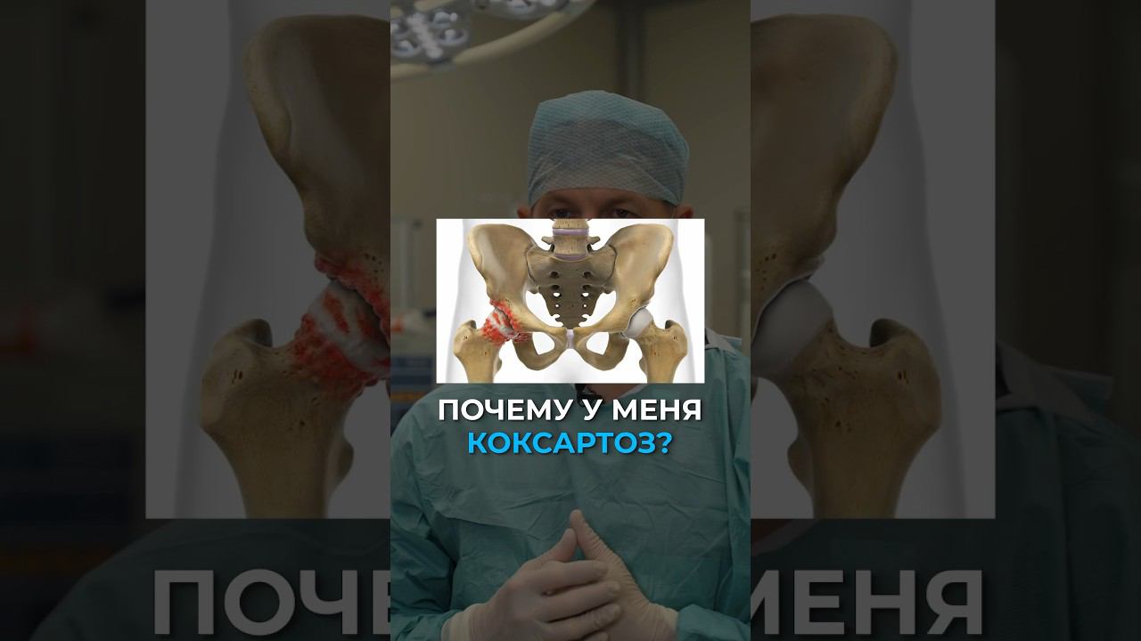 Почему у меня коксартроз?