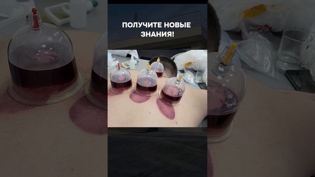 ОБУЧЕНИЕ ХИДЖАМЕ! Капиллярное кровопускание | НАУЧИМ ВСЕХ