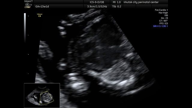 ППИ начало смотреть онлайн