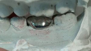 Cad-cam цельнолитая коронка Harz Labs