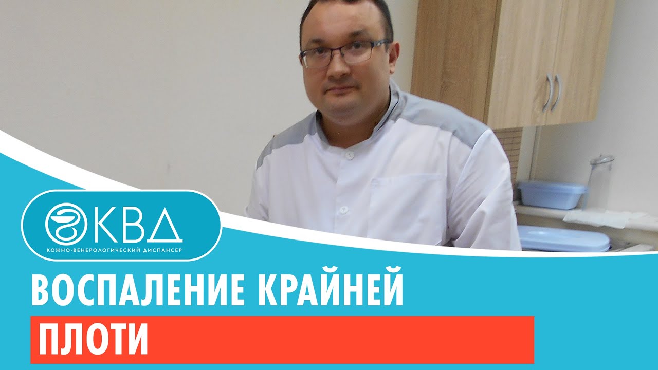 Воспаление крайней плоти. Клинический случай №91