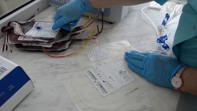 Получение пулированных фильтрованных тромбоцитов