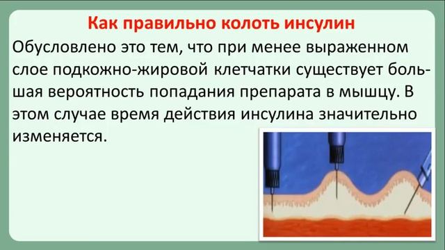 В какое место колоть инсулин. Введение инсулина подкожно. Введение инсулина подкожно шприц ручкой. Введение инсулина шприц ручкой алгоритм. Техника введения инсулина подкожно