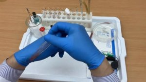 Определение резус-принадлежности крови (резус-фактора) в пробирке без подогрева