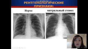 Приобретенные пороки сердца