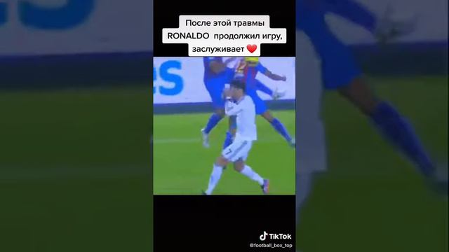 После этой травмы RONALDO продолжил игру😪