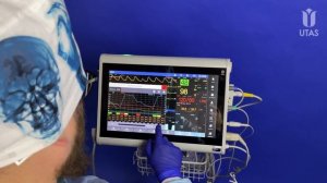 UM 300 Patient Monitors: High-quality Monitoring — Key Factor In The Patient Safety