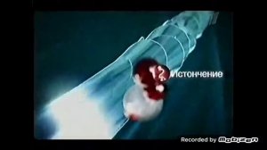 loreal elseve восстановление 5 2010 реклама