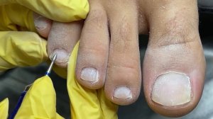 Мужской педикюр ? / Обработка пяток аппаратом