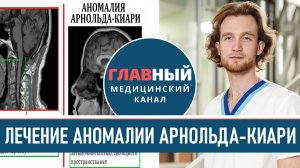 Лечение Аномалии Арнольда-Киари. Синдром Арнольда Киари операция. Тонзиллярная эктопия мозжечка