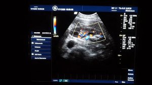 GE Logiq 9 обзор ультразвукового сканера