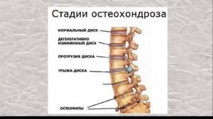 Гимнастика ниши для позвоночника