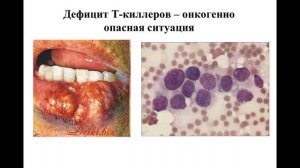 Лекция 08.
Все факультеты.
ИДС (Иммунодефициты).