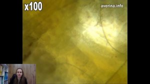 ? Прозрачная белая мокрица – чешуйница, под микроскопом. Как избавиться