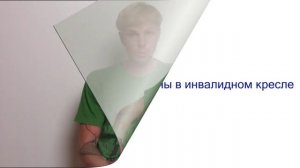 Обзор катетеров Coloplast