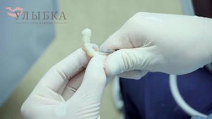 Металлокерамические и цельноциркониевые коронки