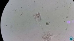 Одинокий танец инфузории Vorticella