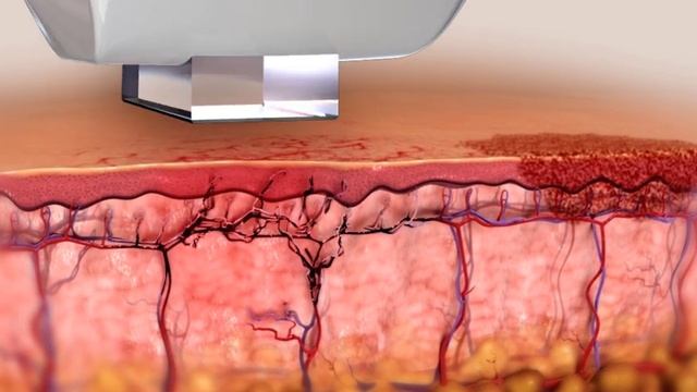 Lumecca 2017 смотреть онлайн