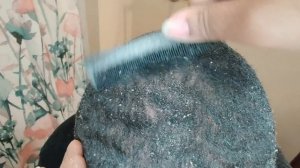 Dandruff Pile Up(Brielle has a lot to say. ?Mute for relaxation)