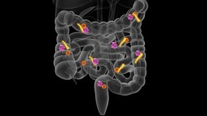 Genetics and Environment in IBD