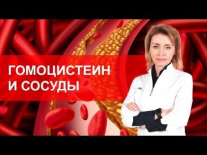 Гомоцистеин и сосуды. Мнение кардиолога. Анна Кореневич