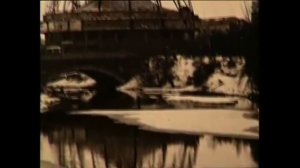 Сепсис 002 Сибирская язва 79 ТАУ.