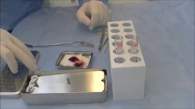 Получение мембран APRF в специальном боксе смотреть онлайн