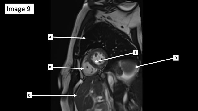 Radiology Anatomy Quiz #3 смотреть онлайн