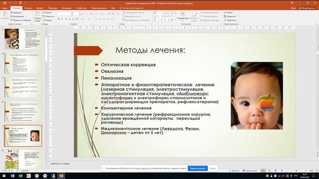 Амблиопия. Докладчик: Лазарчук М. 29.04.2022