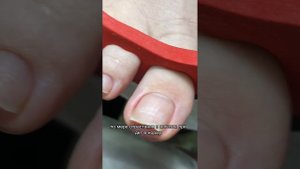 Гипонихий за 2 месяца. Или почему важно убирать длину вовремя! #ногинск #педикюр #маникюрногинск