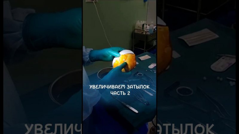 Смотрите продолжение в следующем видео