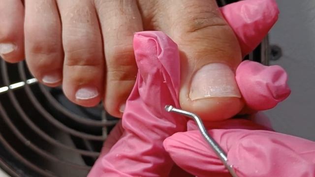 Сильно отросли ногти. Скорее исправляем. смотреть онлайн