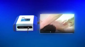 Аппарат ударно-волновой терапии (УВТ) LGT-2500S (Видео 1)