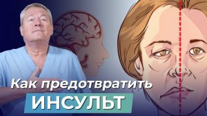 ИНСУЛЬТ НЕ ПРИГОВОР! Восстановление ПОСЛЕ ИНСУЛЬТА. Как улучшить приток крови к головному мозгу?