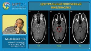 Дифференциальная диагностика очаговых и объемных изменений головного мозга по МРТ