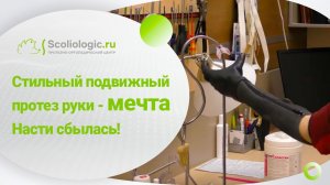 Новый подвижный протез руки - новые возможности для Насти.