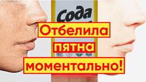 МАСКА С СОДОЙ – СИЛЬНЕЙШЕЕ ОТБЕЛИВАНИЕ?И ОМОЛОЖЕНИЕ!