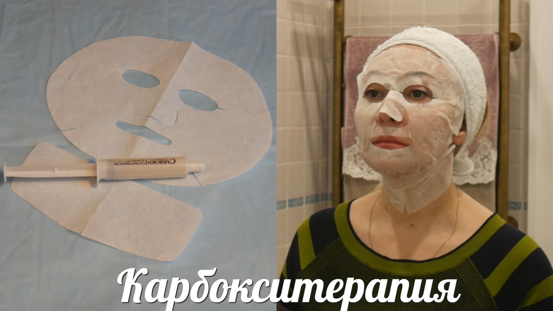 Карбокситерапия для дома
