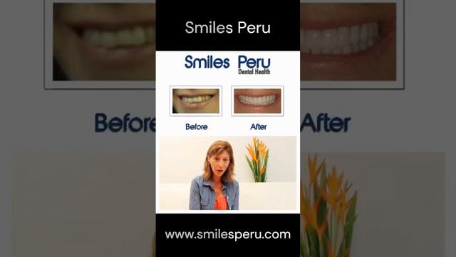 Porcelain Crowns, Veneers, and Bridges Testimonial