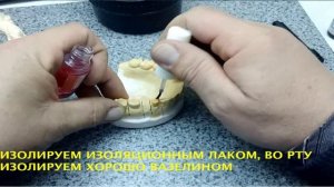 Изготовление временных коронок