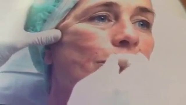 Работа с нитями Silhouette Soft (Силуэт Софт). estet-portal.com смотреть онлайн