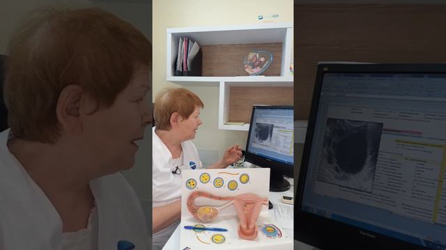 Кіста яєчника: діагностика та лікування смотреть онлайн