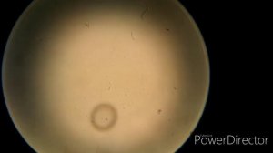 Вода из лужи под микроскопом/ЧТО ТАМ ЗА ОРГАНИЗМЫ?