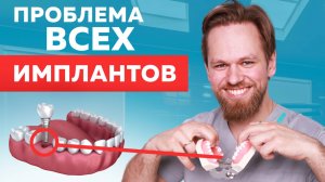 ВСЁ про зубные ИМПЛАНТЫ (цена, установка имплантов зубов, гарантия)