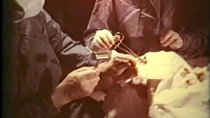 Хирургия переломов орбиты, автотравмы, академик О.В.Груша © Treatment of fractures of the orbit