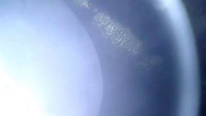 Эндоскопия впускных и выпускных клапанов.mp4