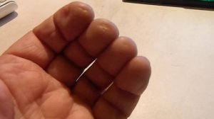 Мозоли от игры на гитаре.